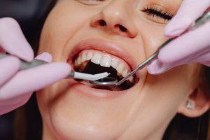 Preventing Gingivitis and Periodontitis: Tips and Treatments for Gum Health