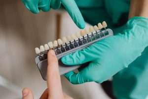 Are Dental Implants Right for You? Factors to Consider